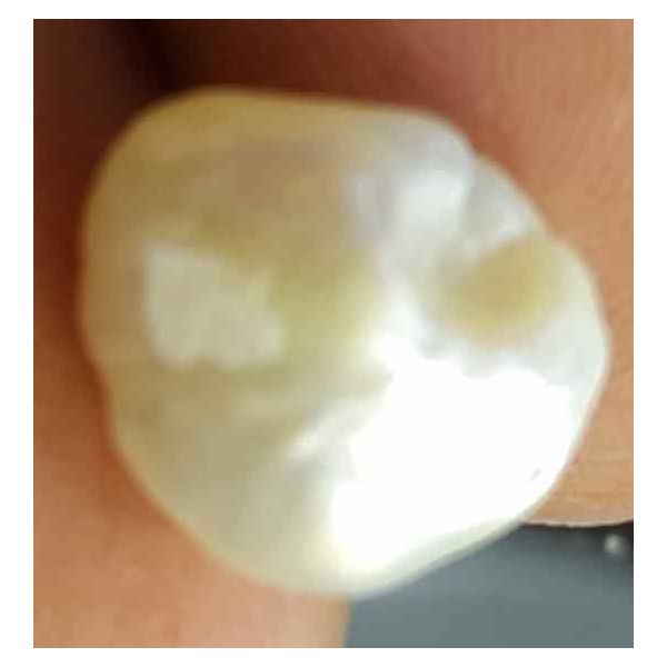 4.38 Carat Venezuela Pearl 10.33 X 9.33 X 6.62 mm